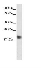 CSRP3 Antibody - Fetal Muscle Lysate.  This image was taken for the unconjugated form of this product. Other forms have not been tested.