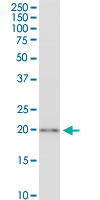 CSRP3 Antibody - CSRP3 monoclonal antibody (M03), clone 6D2. Western Blot analysis of CSRP3 expression in HeLa NE.