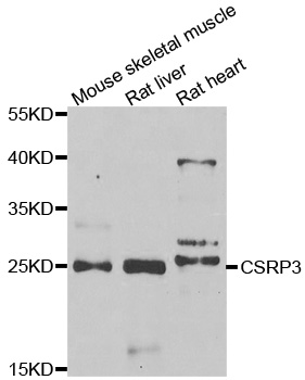 CSRP3 Antibody - Western blot analysis of extracts of various cell lines.