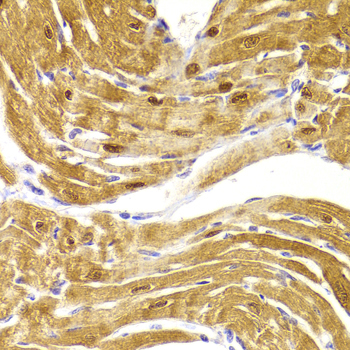 CSRP3 Antibody - Immunohistochemistry of paraffin-embedded Mouse heart.