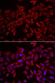 CSRP3 Antibody - Immunofluorescence analysis of HeLa cells.