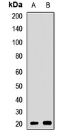 CSRP3 Antibody