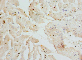 CSRP3 Antibody - Immunohistochemistry of paraffin-embedded Human heart tissue at dilution 1:100