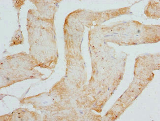 CSRP3 Antibody - Immunohistochemistry of paraffin-embedded human skeletal muscle tissue at dilution 1:100