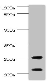 CSRP3 Antibody - Western blot All Lanes:CSRP3 antibody at 1ug/ml+mouse skeletal muscle tissue Secondary Goat polyclonal to rabbit at 1/10000 dilution Predicted band size: 21kDa Observed band size: 21kDa,25kDa