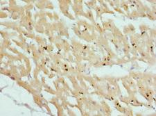 CSRP3 Antibody - Immunohistochemistry of paraffin-embedded Human heart tissue at dilution 1:100