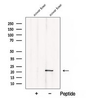 CSRP3 Antibody - Western blot analysis of extracts of mouse heart tissue using CSRP3 antibody. The lane on the left was treated with blocking peptide.