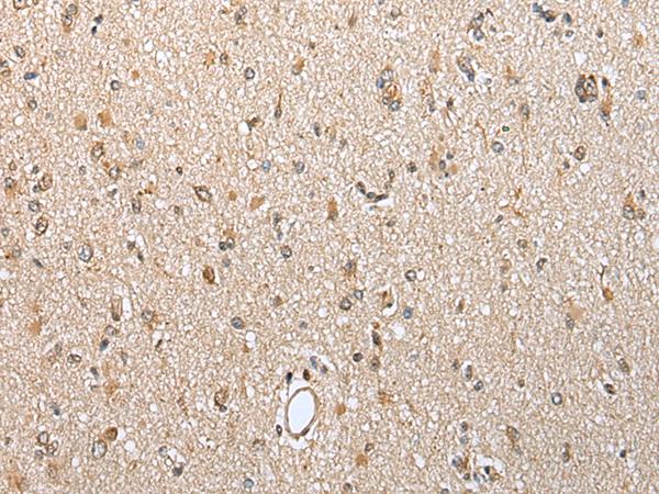 CSRP3 Antibody - Immunohistochemistry of paraffin-embedded Human brain tissue  using CSRP3 Polyclonal Antibody at dilution of 1:40(×200)