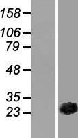 CSRP3 Protein - Western validation with an anti-DDK antibody * L: Control HEK293 lysate R: Over-expression lysate