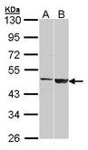 CST / GAL3ST1 Antibody - Sample (30 ug of whole cell lysate). A: H1299, B: Raji. 10% SDS PAGE. CST / GAL3ST1 antibody diluted at 1:1000.
