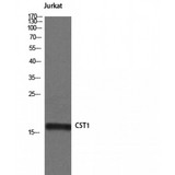 CST1 / Cystatin SN Antibody - Western blot of Cystatin SN antibody
