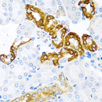 CST1 / Cystatin SN Antibody - Immunohistochemistry of paraffin-embedded mouse kidney using CST1 antibody at dilution of 1:100 (40x lens).