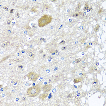 CST1 / Cystatin SN Antibody - Immunohistochemistry of paraffin-embedded rat brain using CST1 antibody at dilution of 1:100 (40x lens).