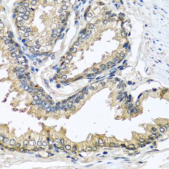 CST1 / Cystatin SN Antibody - Immunohistochemistry of paraffin-embedded human prostate using CST1 antibody at dilution of 1:100 (40x lens).