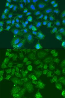 CST1 / Cystatin SN Antibody - Immunofluorescence blot of A549 cell using CST1 antibody. Blue: DAPI for nuclear staining.