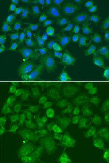 CST1 / Cystatin SN Antibody - Immunofluorescence analysis of A549 cells using CST1 antibody. Blue: DAPI for nuclear staining.