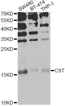 CST1 / Cystatin SN Antibody - Western blot analysis of extracts of various cell lines, using CST1 Antibody at 1:1000 dilution. The secondary antibody used was an HRP Goat Anti-Rabbit IgG (H+L) at 1:10000 dilution. Lysates were loaded 25ug per lane and 3% nonfat dry milk in TBST was used for blocking. An ECL Kit was used for detection and the exposure time was 30s.