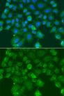CST1 / Cystatin SN Antibody - Immunofluorescence analysis of A549 cells using CST1 Polyclonal Antibody.