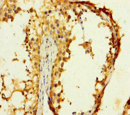 CST11 Antibody - Immunohistochemistry of paraffin-embedded human testis tissue using CST11 Antibody at dilution of 1:100