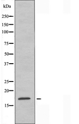 CST11 Antibody - Western blot analysis of extracts of A549 cells using CST11 antibody.
