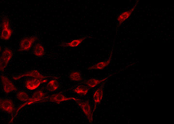 CST11 Antibody - Staining A549 cells by IF/ICC. The samples were fixed with PFA and permeabilized in 0.1% Triton X-100, then blocked in 10% serum for 45 min at 25°C. The primary antibody was diluted at 1:200 and incubated with the sample for 1 hour at 37°C. An Alexa Fluor 594 conjugated goat anti-rabbit IgG (H+L) Ab, diluted at 1/600, was used as the secondary antibody.