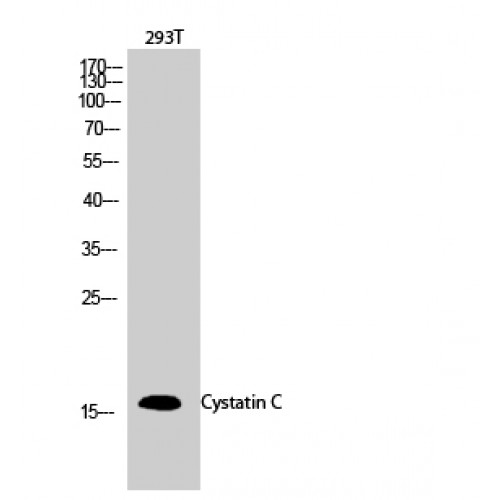CST3 / Cystatin C Antibody - Western blot of Cystatin C antibody