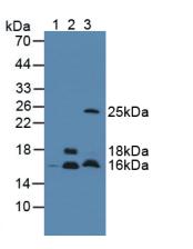 CST3 / Cystatin C Antibody - Western Blot; Sample: Lane1: Mouse Serum; Lane2: Mouse Brain Tissue; Lane3: Mouse Testis Tissue.