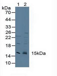 CST3 / Cystatin C Antibody - Western BlotSample: Lane1: Human Serum; Lane2: Rat Brain Tissue.