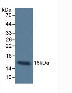 CST3 / Cystatin C Antibody - Western Blot; Sample: Human Urine.