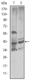 CST3 / Cystatin C Antibody - Western blot using CST3 mouse monoclonal antibody against HeLa (1) and Caco-2 (2) cell lysate.