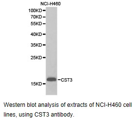 CST3 / Cystatin C Antibody - Western blot.