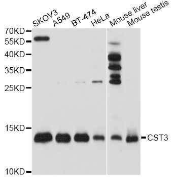 CST3 / Cystatin C Antibody - Western blot analysis of extracts of various cell lines, using CST3 antibody at 1:1000 dilution. The secondary antibody used was an HRP Goat Anti-Rabbit IgG (H+L) at 1:10000 dilution. Lysates were loaded 25ug per lane and 3% nonfat dry milk in TBST was used for blocking. An ECL Kit was used for detection and the exposure time was 10s.