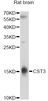 CST3 / Cystatin C Antibody - Western blot analysis of extracts of rat brain, using CST3 antibodyat 1:1000 dilution. The secondary antibody used was an HRP Goat Anti-Rabbit IgG (H+L) at 1:10000 dilution. Lysates were loaded 25ug per lane and 3% nonfat dry milk in TBST was used for blocking. An ECL Kit was used for detection and the exposure time was 30s.
