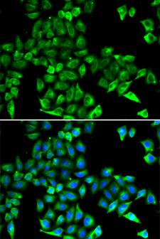 CST3 / Cystatin C Antibody - Immunofluorescence analysis of HeLa cells using CST3 antibody. Blue: DAPI for nuclear staining.