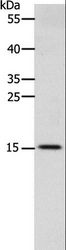 CST3 / Cystatin C Antibody - Western blot analysis of Human fetal brain tissue, using CST3 Polyclonal Antibody at dilution of 1:2400.
