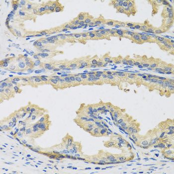 CST3 / Cystatin C Antibody - Immunohistochemistry of paraffin-embedded human prostate using CST3 antibody at dilution of 1:100 (40x lens).