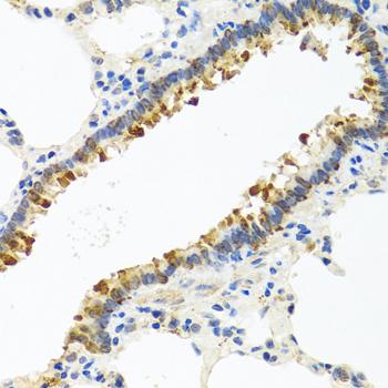 CST4 / Cystatin S Antibody - Immunohistochemistry of paraffin-embedded Rat lung using CST4 Polyclonal Antibody at dilution of 1:100 (40x lens).