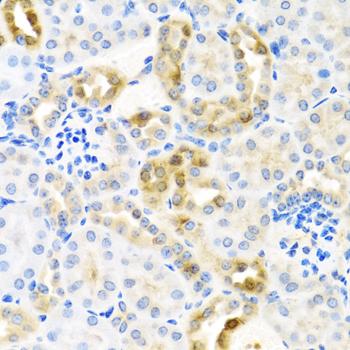 CST4 / Cystatin S Antibody - Immunohistochemistry of paraffin-embedded Mouse kidney using CST4 Polyclonal Antibody at dilution of 1:100 (40x lens).