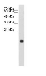 CST4 / Cystatin S Antibody - HepG2 Cell Lysate.  This image was taken for the unconjugated form of this product. Other forms have not been tested.