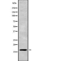 CST5 Antibody - Western blot analysis of CST5 using NIH-3T3 whole cells lysates