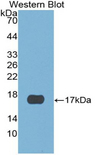 CST6 / Cystatin E/M Antibody - Western blot of recombinant CST6.