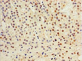 CST6 / Cystatin E/M Antibody - Immunohistochemistry of paraffin-embedded human adrenal gland using antibody at 1:100 dilution.