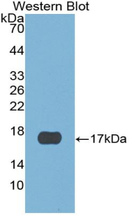 CST6 / Cystatin E/M Antibody - Western blot of recombinant CST6.