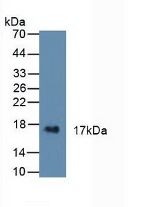 CST6 / Cystatin E/M Antibody - Western Blot; Sample: Human Urine.