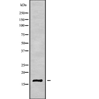 CST6 / Cystatin E/M Antibody - Western blot analysis of CST6 using K562 whole cells lysates