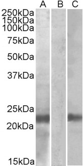 CST8 / CRES Antibody - HEK293 lysate (10ug protein in RIPA buffer) overexpressing Human CST8 (RC210130) with C-terminal MYC tag probed with (1ug/ml) in Lane A and probed with anti-MYC Tag (1/1000) in lane C. Mock-transfected HEK293 probed (1mg/ml) in Lane B