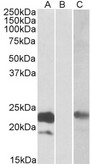 CST8 / CRES Antibody - HEK293 lysate (10ug protein in RIPA buffer) overexpressing Human CST8 (RC210130) with C-terminal MYC tag probed with (0.3ug/ml) in Lane A and probed with anti-MYC Tag (1/1000) in lane C. Mock-transfected HEK294 probed with (1mg/ml) in Lane