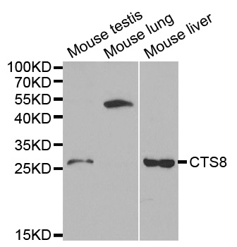 CST8 / CRES Antibody - Western blot analysis of extracts of various cell lines, using CST8 antibody at 1:1000 dilution. The secondary antibody used was an HRP Goat Anti-Rabbit IgG (H+L) at 1:10000 dilution. Lysates were loaded 25ug per lane and 3% nonfat dry milk in TBST was used for blocking.