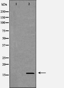 CST8 / CRES Antibody - Western blot analysis of HEK293 cell lysates using CST8 antibody. The lane on the left is treated with the antigen-specific peptide.