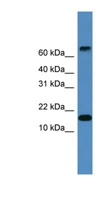 CST9 Antibody - CST9 antibody Western blot of Fetal Heart lysate. This image was taken for the unconjugated form of this product. Other forms have not been tested.